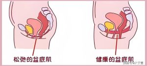 生完孩子后阴道松弛,真的是盆底肌在“报警”吗?-两性知识丨两性健康--你想了解的我都知道