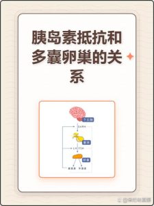 多囊和胰岛素抵抗有关系吗-两性知识丨两性健康--你想了解的我都知道