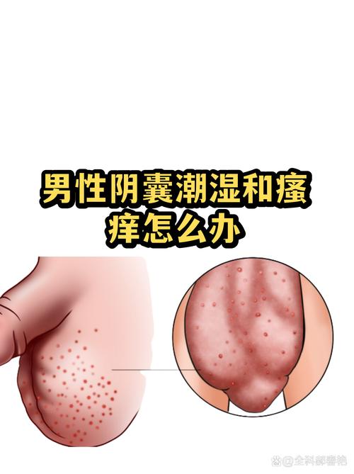 阴囊潮湿反复,是炎症还是皮肤问题