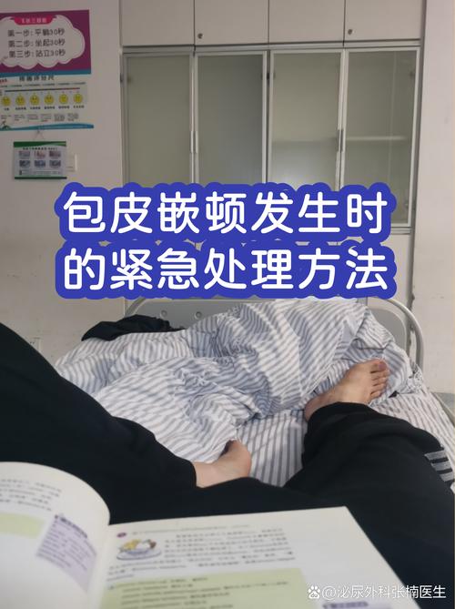 包皮嵌顿要怎么紧急处理