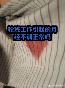 经常倒班熬夜的人,真的更难怀上孩子吗-两性知识丨两性健康--你想了解的我都知道