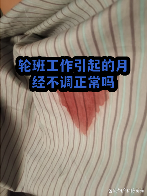 轮班工作影响生育吗