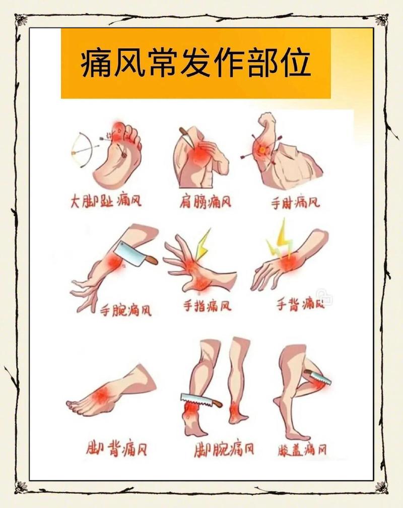 性欲低和痛风有关吗