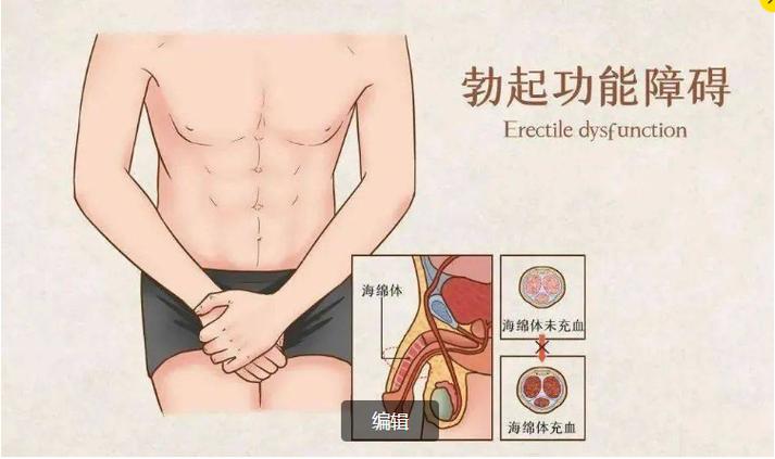 偶尔一次勃起失败,算不算阳痿