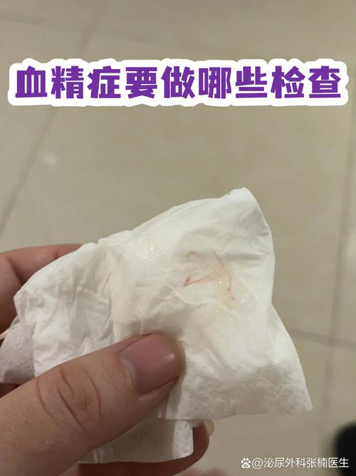 血精反复出现,该做什么检查