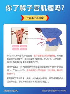 查出子宫肌瘤，是不是就代表夫妻生活要变淡了？-两性知识丨两性健康--你想了解的我都知道