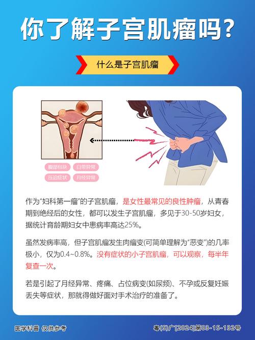 子宫肌瘤会导致性欲下降吗