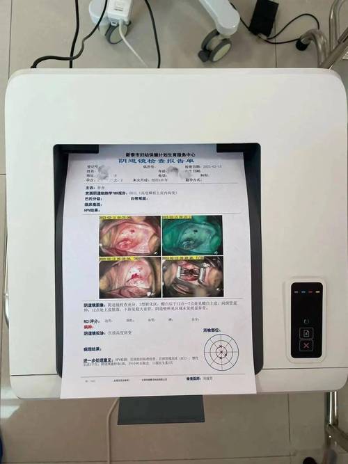 高危型HPV持续感染需要做阴道镜吗