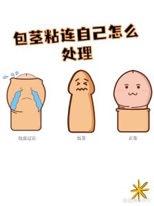 包皮龟头粘连需要处理吗？一文说清家长们的常见困惑-两性知识丨两性健康--你想了解的我都知道