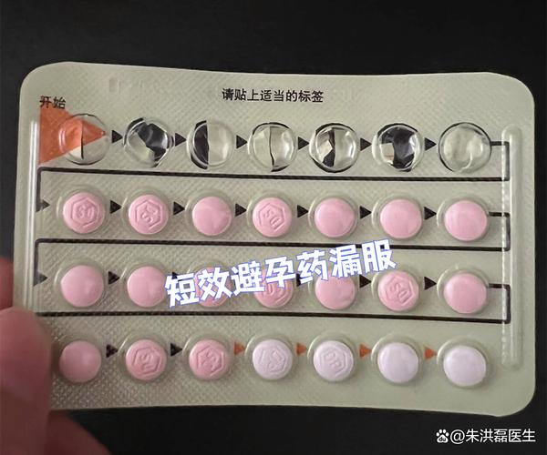 短效避孕药漏服后要补吃吗