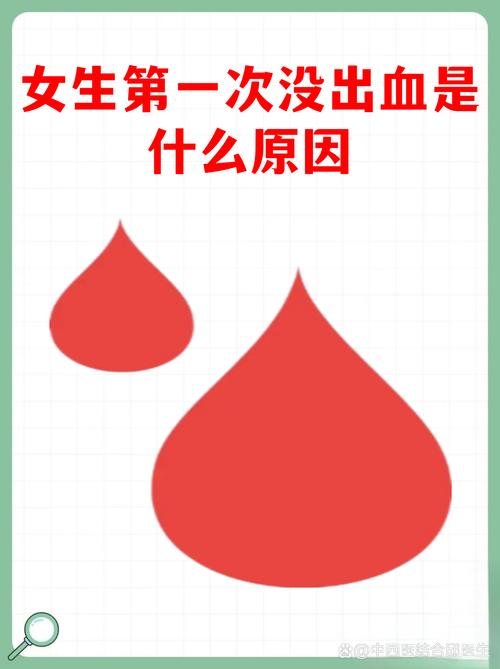 第一次同房没有出血正常吗