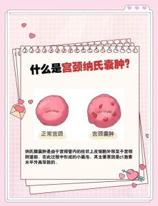 宫颈纳囊随访这件事,大多时候不用太紧张-两性知识丨两性健康--你想了解的我都知道