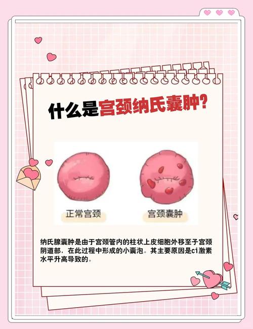 宫颈纳囊需要定期随访吗-相关配图