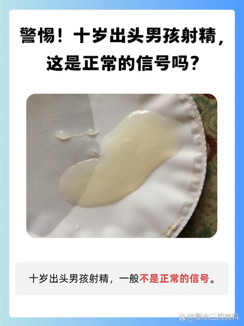 第一次看男科需要准备什么