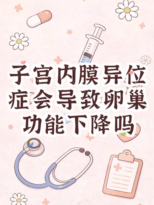 内异症会拖累卵巢储备吗