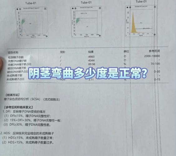 阴茎弯曲多少度需要就医-相关配图