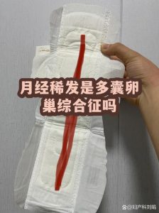 月经稀发就一定是多囊吗？别急着给自己下诊断！-两性知识丨两性健康--你想了解的我都知道