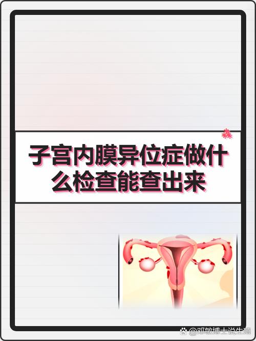 子宫内膜异位症确诊靠哪些检查