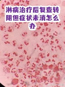 淋病治完想确认转阴，复查节奏比吃药更关键-两性知识丨两性健康--你想了解的我都知道