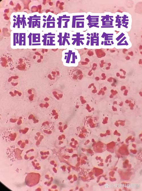 淋病规范治疗后怎么复查转阴-示意图