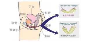 盆底肌高张真的会导致性交痛吗？-两性知识丨两性健康--你想了解的我都知道