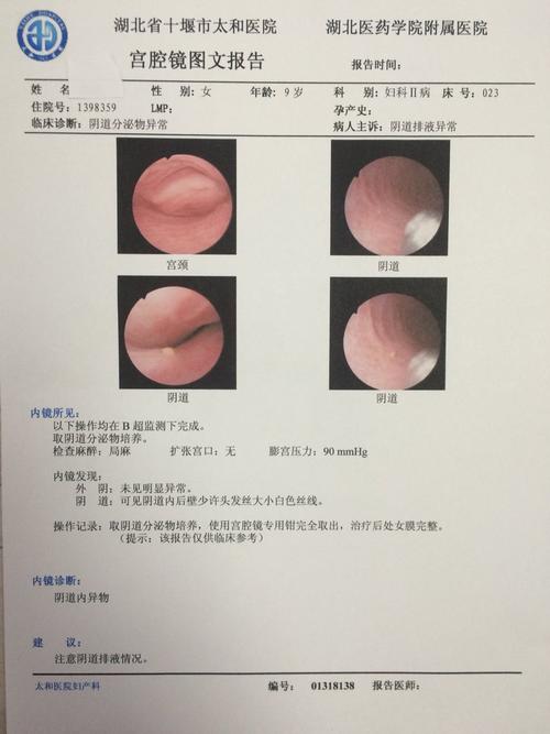 阴道炎反复发作要查什么