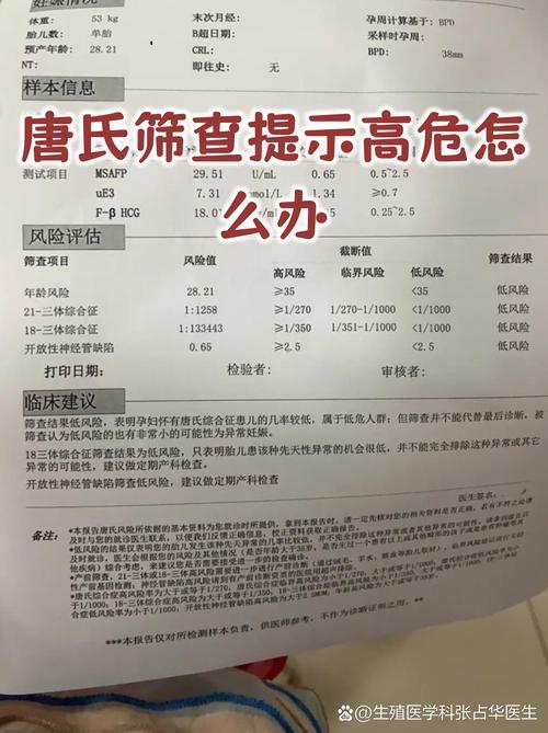 唐筛高风险后如何选择确诊方式