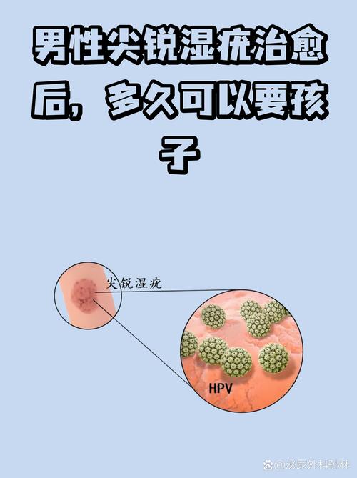 男性HPV感染能自己转阴吗