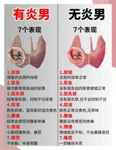 前列腺炎会引起早泄吗?真相和应对方法一次说清-两性知识丨两性健康--你想了解的我都知道