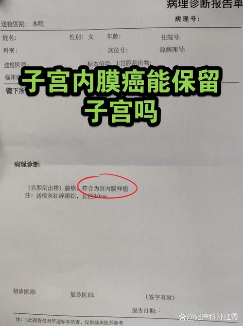 子宫内膜癌能保留子宫吗