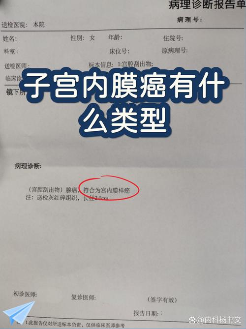 子宫内膜癌能保留子宫吗