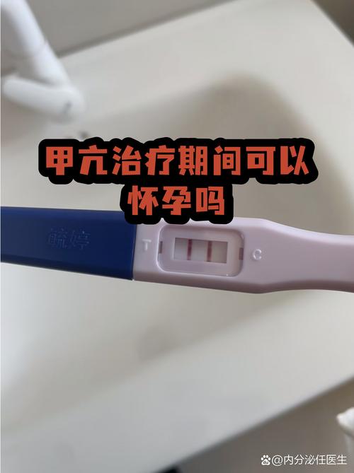 甲亢治疗期间能怀孕吗