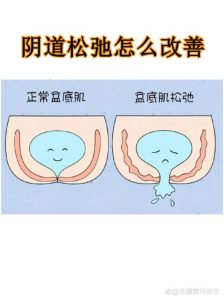 年龄越大盆底肌越松?真相和你想的不太一样-两性知识丨两性健康--你想了解的我都知道