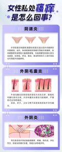 外阴反复瘙痒查因，先把这四类源头分清-两性知识丨两性健康--你想了解的我都知道