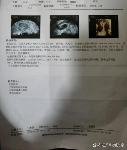 宫腔粘连复发率为什么这么高