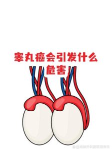 睾丸癌会影响生育吗?-两性知识丨两性健康--你想了解的我都知道