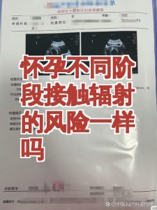 孕期接触辐射会致畸吗?准妈妈必看的科学解答-两性知识丨两性健康--你想了解的我都知道