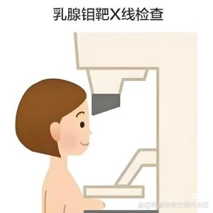 乳腺检查选超声还是钼靶？一文帮你理清思路-两性知识丨两性健康--你想了解的我都知道