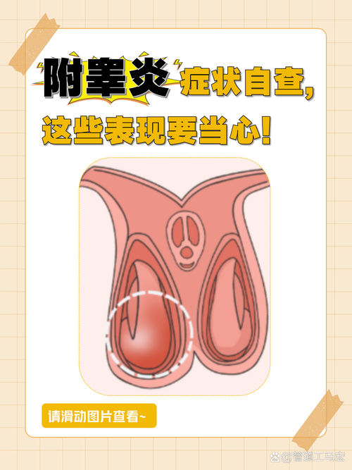 附睾发炎会影响性欲吗