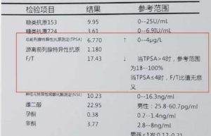 PSA升高还需要做哪些进一步检查？-两性知识丨两性健康--你想了解的我都知道