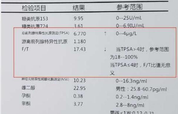 PSA升高还需要做哪些进一步检查
