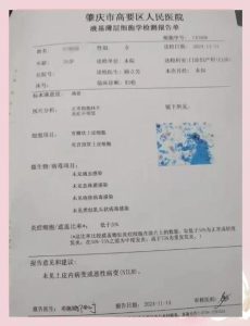 伴侣一方转阴后的复查节奏,其实比想象中清晰-两性知识丨两性健康--你想了解的我都知道