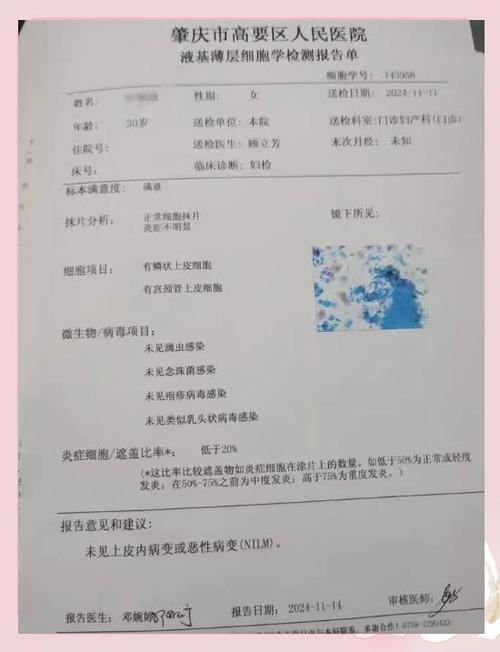 夫妻一方转阴后还要复查吗-示意图