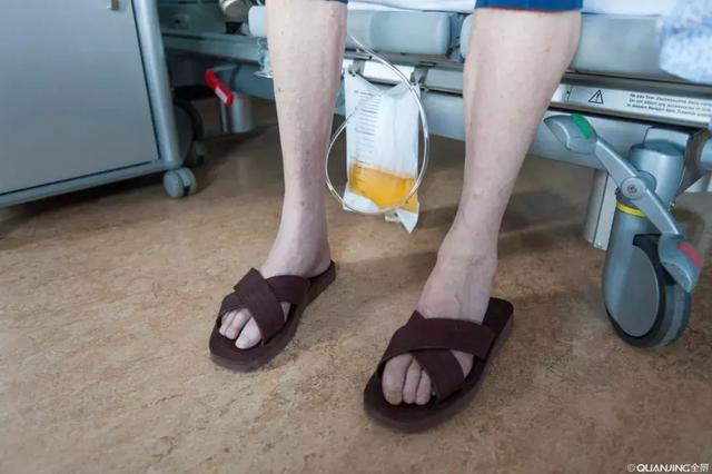 前列腺癌内分泌治疗常见不适有哪些