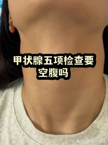 甲状腺功能检查需要空腹吗?一文说清-两性知识丨两性健康--你想了解的我都知道