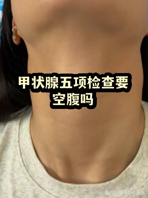甲状腺功能要空腹查吗