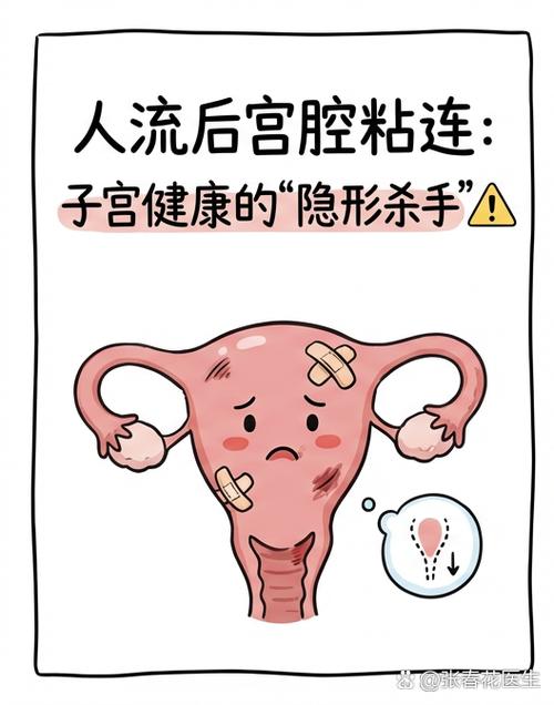 人流后月经变少要警惕粘连