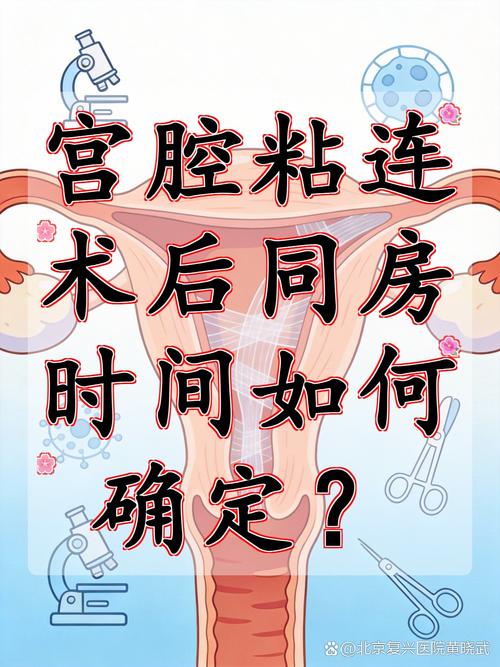 宫腔粘连术后多久能同房