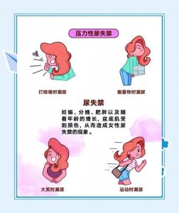 大笑或咳嗽时漏尿正常吗？-两性知识丨两性健康--你想了解的我都知道