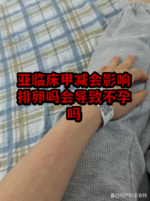 甲减会影响排卵和受孕吗